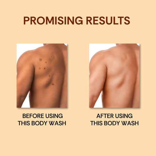 Hydrating Gilli Mitti <br> Body Wash (Pack of 2)